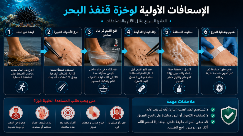 إنفوغرافيك احترافي يشرح الإسعافات الأولية الصحيحة لوخزة قنفذ البحر وخطوات علاج الأشواك البحرية بطريقة آمنة للغواصين والسباحين